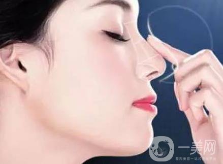 分段式假體隆鼻