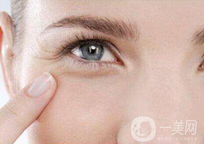祛除眼角魚尾紋