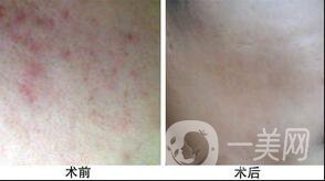 復(fù)合彩光調(diào)節(jié)