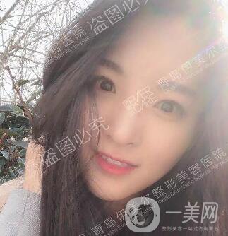 開(kāi)眼角價(jià)格