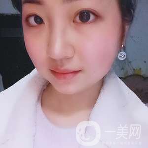 去頰脂墊瘦臉、