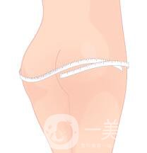 360度環(huán)形吸脂*果如何