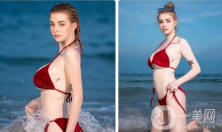 乳房縮小是為了什么呢 來聽聽專家的解說