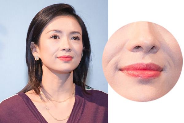 去法令紋多少錢