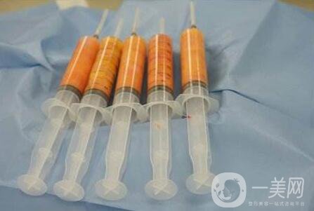 自體脂肪,皮膚科手術(shù),脂肪壞死,脂肪轉(zhuǎn)移