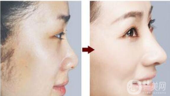 贛榆?chē)?guó)泰整形醫(yī)院