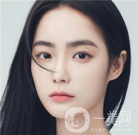 成都雙眼皮*果如何