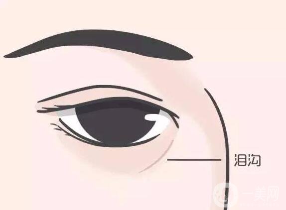 納米脂肪填充淚溝*果如何_圖片