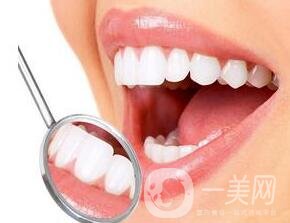 北京烤瓷牙價格及種類詳情?