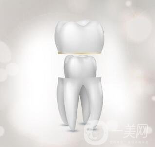 烤瓷牙的種類和優(yōu)缺點(diǎn)分別是什么呢？