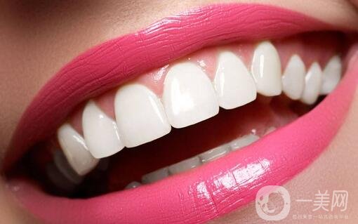 烤瓷牙的種類和優(yōu)缺點(diǎn)分別是什么呢？