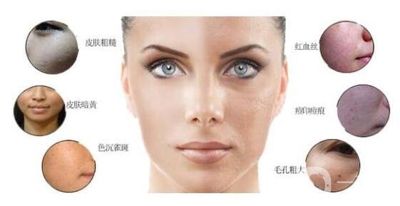 光子嫩膚適合人群有哪些?