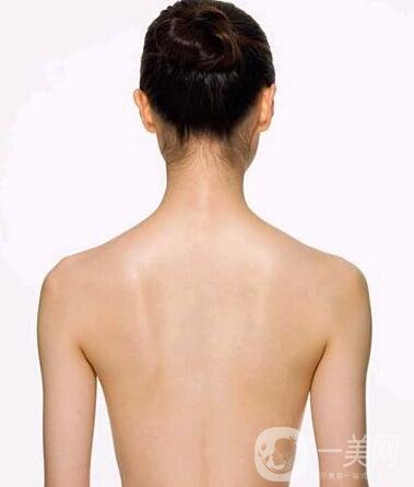 后背吸脂1000毫升多嗎？有*的瘦背*果嗎？