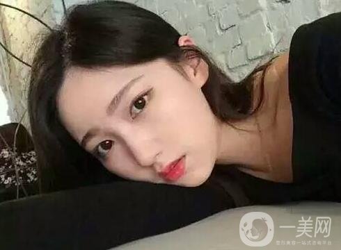 雙下巴吸脂后一個(gè)月還是有雙下巴，是失敗了嗎?