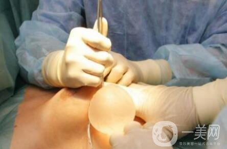 隆胸假體取出有沒有后遺癥？要怎么護(hù)理？