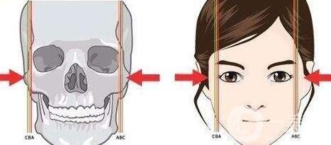 哪家醫(yī)院做削骨手術(shù)比較*？正規(guī)醫(yī)院怎么選？