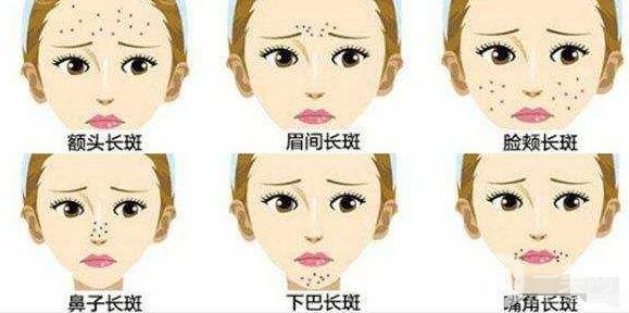 激光祛斑的優(yōu)勢有哪些?為什么這么多人去做?