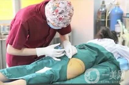 大腿抽脂多久恢復(fù)正常?恢復(fù)階段變化解說