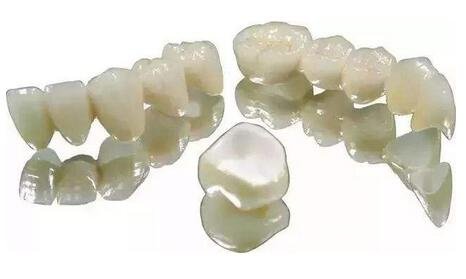 二氧化鋯全瓷牙修復(fù)*果怎么樣？