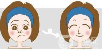 假體隆鼻的前后照片 這差距也太大了吧~