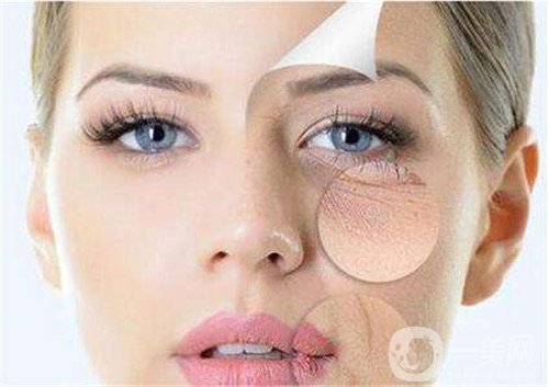 激光去眼袋的價格多少？要打幾次？