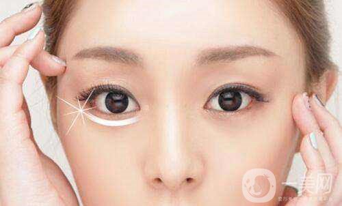 激光去眼袋的價格多少？要打幾次？