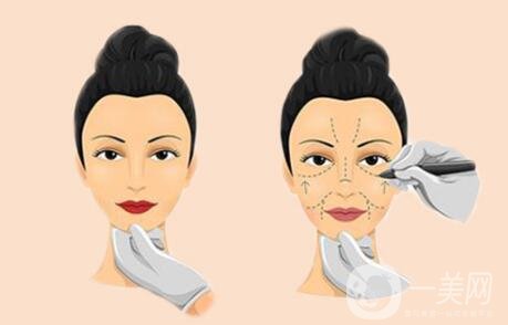 自體脂肪豐太陽(yáng)穴