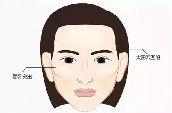 顴骨內(nèi)推和磨骨之間的區(qū)別是什么？哪個(gè)*果好些？