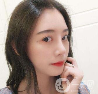 肋軟骨隆鼻為什么老受推薦？到底好在哪里？