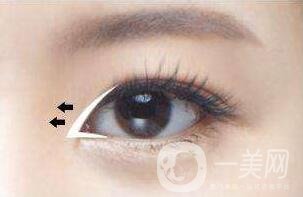 開眼角眼睛會(huì)變大嗎？眼睛會(huì)變長嗎？