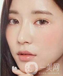 開眼角前后照片圖，放大眼睛不是一點(diǎn)點(diǎn)