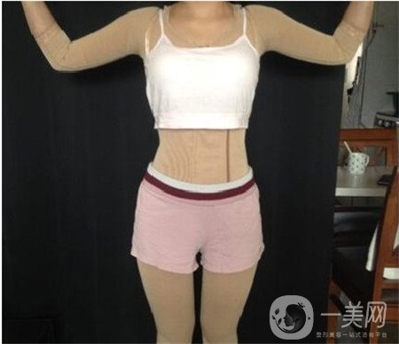 局部吸脂痛苦嗎?多久可以恢復(fù)呢?