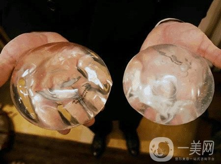 曼托假體和麥格假體哪種手感更好？教你怎么選擇？