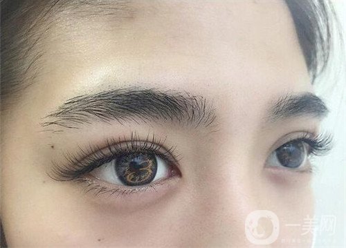 眼部衰老怎么辦？做手術(shù)是*好的解決辦法！