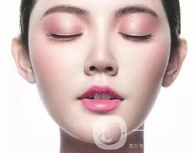 面部抽脂多久可以消腫恢復？*小妙招~