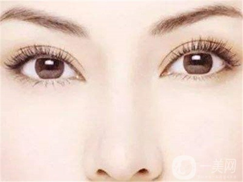 假體隆鼻多久完全消腫？怎么加速消腫呢？