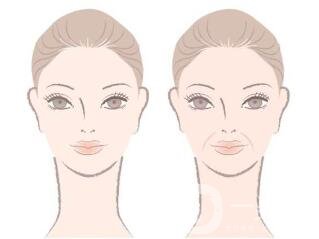 怎樣去鼻唇溝法令紋?小炒招~