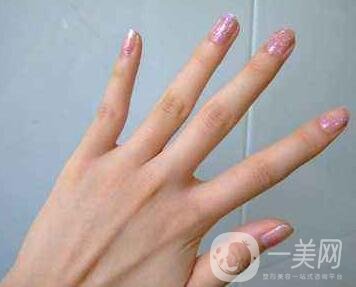 怎樣去掉手上的老年斑？還會再生嗎？