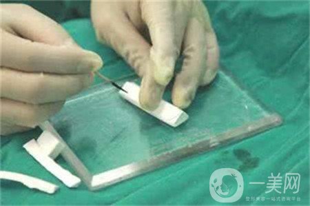 膨體隆鼻缺點(diǎn)是什么？?jī)?yōu)點(diǎn)有哪些？