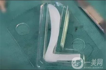 膨體隆鼻缺點(diǎn)是什么？?jī)?yōu)點(diǎn)有哪些？