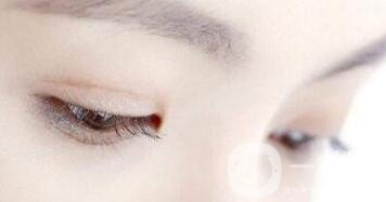 韓式微創(chuàng)雙眼皮手術(shù)