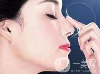 鼻子整形價格多少錢？影響價格因素有哪些？