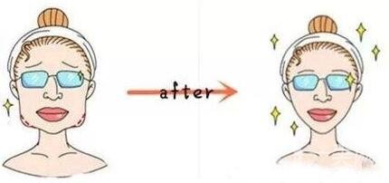 微創(chuàng)改臉型多少錢?貴不貴?