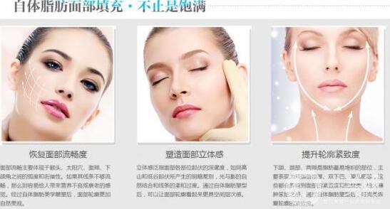 自體脂肪填充臉會(huì)僵嗎?術(shù)后感覺是怎樣的?