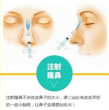 自體脂肪填充隆鼻部會不會變寬?