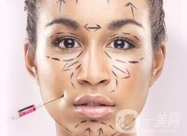 自體脂肪填充法令紋