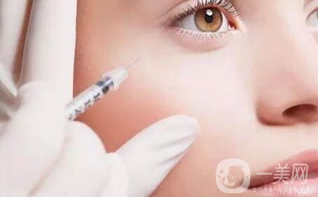 自體脂肪填充全臉術(shù)