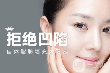 自體脂肪填充太陽穴