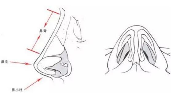 夏天做假體隆鼻好嗎?有沒有要注意的?