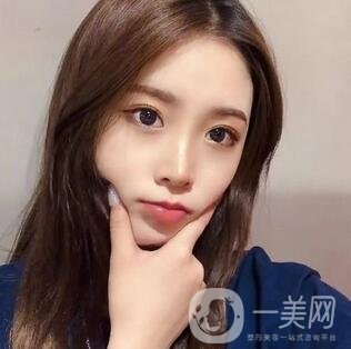 假體隆鼻整形手術(shù)一般多少錢？